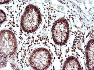 Immunohistochemistry: Necdin Antibody (OTI5D1) [NBP2-46117]