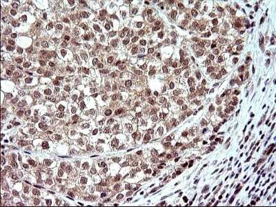 Immunohistochemistry: Necdin Antibody (OTI5D1) [NBP2-46117]