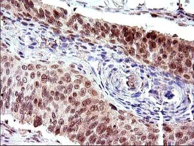 Immunohistochemistry: Necdin Antibody (OTI5D1) [NBP2-46117]