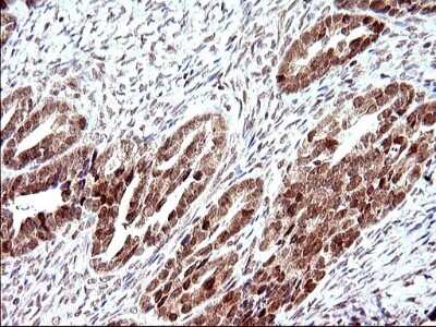 Immunohistochemistry: Necdin Antibody (OTI5D1) [NBP2-46117]