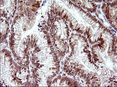 Immunohistochemistry: Necdin Antibody (OTI5D1) [NBP2-46117]