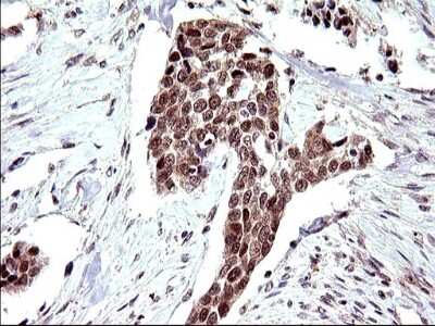 Immunohistochemistry: Necdin Antibody (OTI5D1) [NBP2-46117]