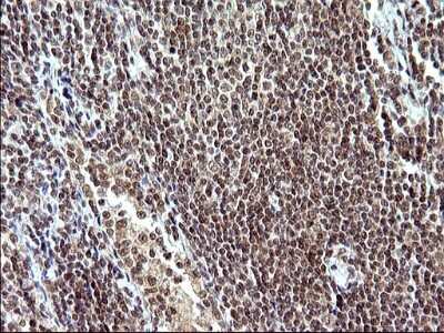 Immunohistochemistry: Necdin Antibody (OTI5D1) [NBP2-46117]