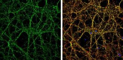 Immunocytochemistry/ Immunofluorescence: Nectin-1/PVRL1 Antibody [NBP3-12960]