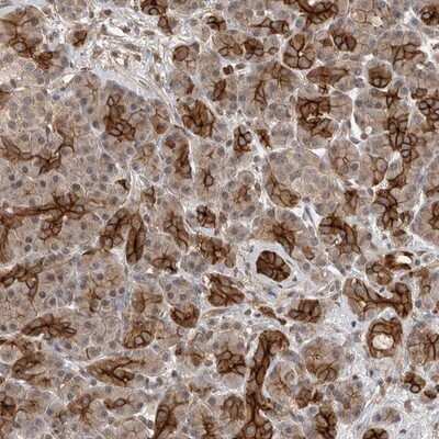 Immunohistochemistry-Paraffin: Nectin-1/PVRL1 Antibody [NBP1-86554]