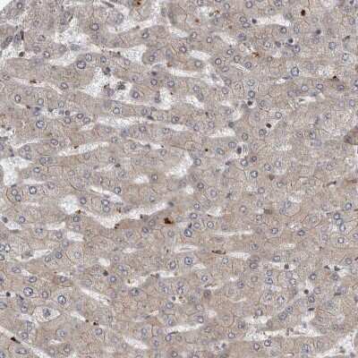 Immunohistochemistry-Paraffin: Nectin-1/PVRL1 Antibody [NBP1-86554]