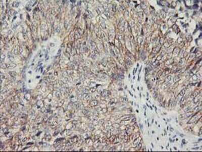 Immunohistochemistry: Nectin-1/PVRL1 Antibody (OTI6F8) - Azide and BSA Free [NBP2-72929]