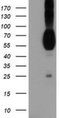 Western Blot: Nectin-1/PVRL1 Antibody (OTI6F8)Azide and BSA Free [NBP2-72929]