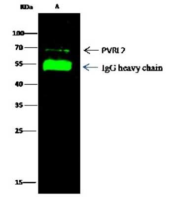 Immunoprecipitation: Nectin-2/CD112 Antibody (110) [NBP2-90530]
