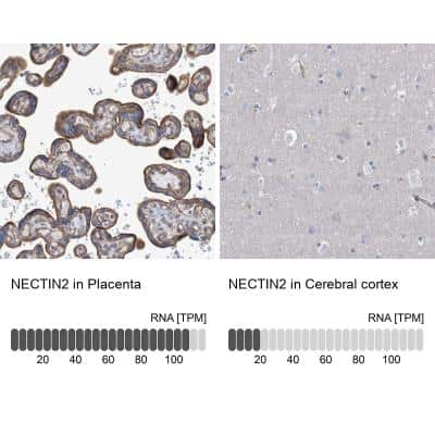 Immunohistochemistry-Paraffin: Nectin-2/CD112 Antibody [NBP1-91211]