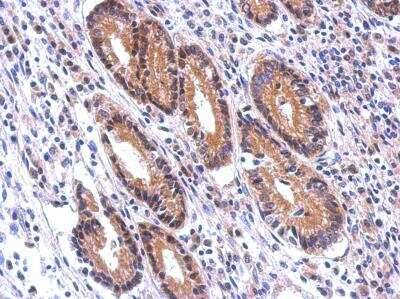 Immunohistochemistry-Paraffin: Nectin-2/CD112 Antibody [NBP2-19507]