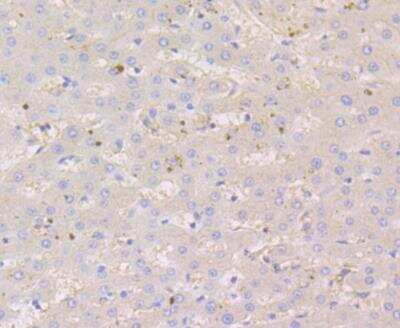 Immunohistochemistry: Nectin-2/CD112 Antibody (JG39-64) [NBP2-76852]