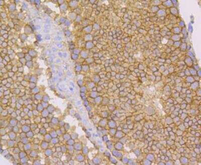 Immunohistochemistry: Nectin-2/CD112 Antibody (JG39-64) [NBP2-76852]