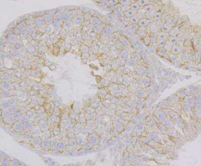 Immunohistochemistry: Nectin-2/CD112 Antibody (JG39-64) [NBP2-76852]