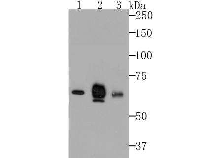 Western Blot: Nectin-2/CD112 Antibody (JG39-64) [NBP2-76852]