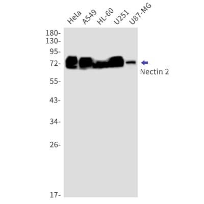 Western Blot: Nectin-2/CD112 Antibody (S06-8F3) [NBP3-20070]