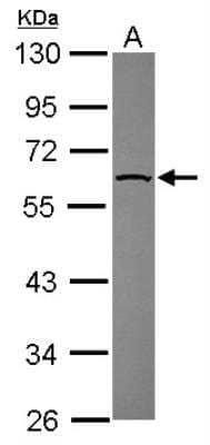 Western Blot: Nectin-2/CD112 Antibody [NBP2-19507]