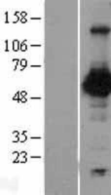 Western Blot: Nectin-2/CD112 Overexpression Lysate [NBP2-11324]