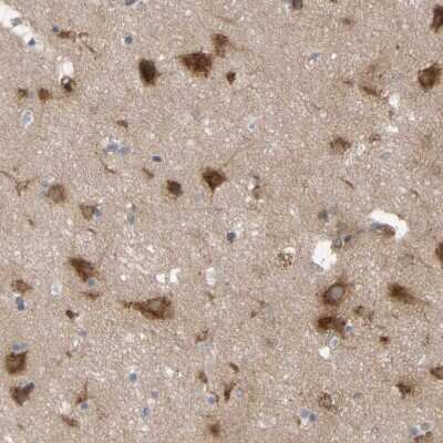 Immunohistochemistry-Paraffin: Nectin-3/PVRL3 Antibody [NBP1-86553]