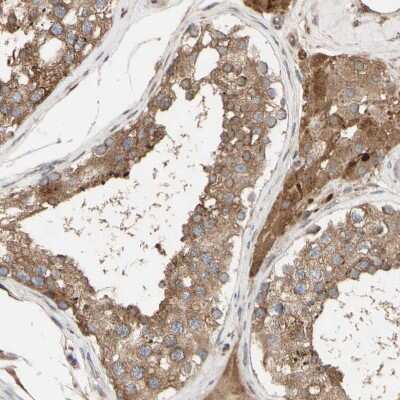 Immunohistochemistry-Paraffin: Nectin-3/PVRL3 Antibody [NBP1-86553]