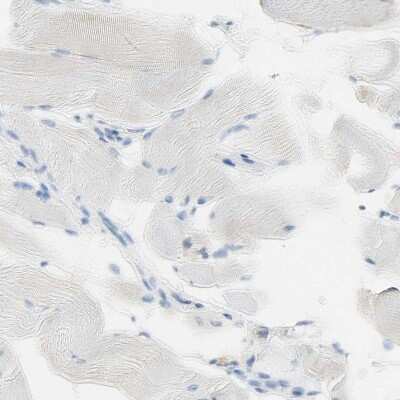 Immunohistochemistry-Paraffin: Nectin-4/PVRL4 Antibody [NBP1-82829]