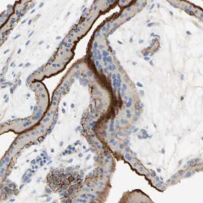 Immunohistochemistry-Paraffin: Nectin-4/PVRL4 Antibody [NBP1-82829]