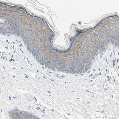 Immunohistochemistry-Paraffin: Nectin-4/PVRL4 Antibody [NBP1-82829]