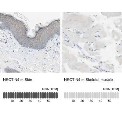 Immunohistochemistry-Paraffin: Nectin-4/PVRL4 Antibody [NBP1-82829]