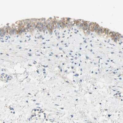 Immunohistochemistry-Paraffin: Nectin-4/PVRL4 Antibody [NBP1-82829]