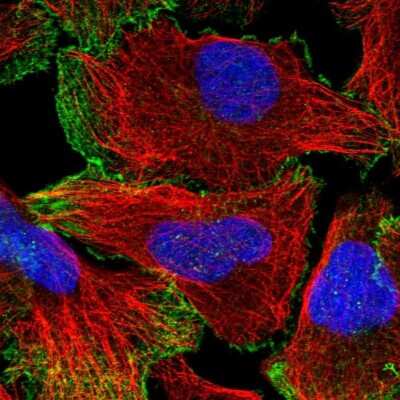Immunocytochemistry/ Immunofluorescence: Neogenin Antibody [NBP1-89651]