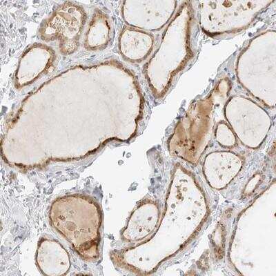 Immunohistochemistry: Neogenin Antibody [NBP1-89652]