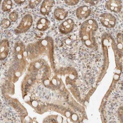 Immunohistochemistry: Neogenin Antibody [NBP1-89653]