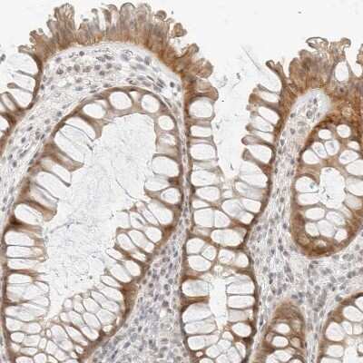 Immunohistochemistry-Paraffin: Neogenin Antibody [NBP1-89651]