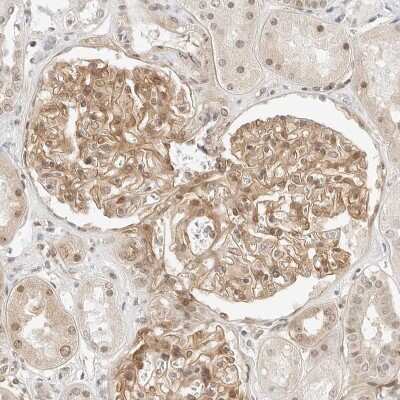 Immunohistochemistry-Paraffin: Neogenin Antibody [NBP1-89651]