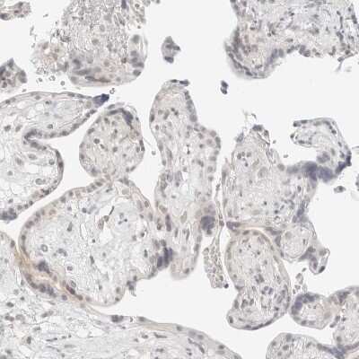 Immunohistochemistry-Paraffin: Neogenin Antibody [NBP1-89651]