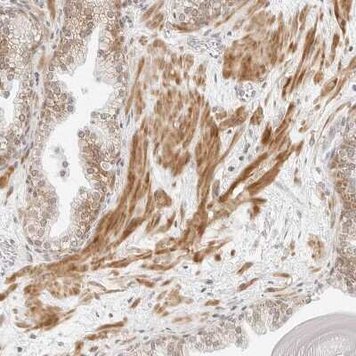 Immunohistochemistry-Paraffin: Neogenin Antibody [NBP1-89651]