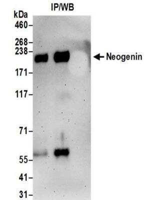 Immunoprecipitation: Neogenin Antibody [NBP2-32272]