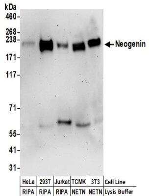 Western Blot: Neogenin Antibody [NBP2-32272]