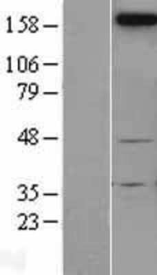 Western Blot: Neogenin Overexpression Lysate [NBL1-13591]