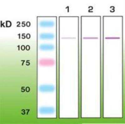 Western Blot: Nephrin Antibody (G17-H) [NBP1-30137]