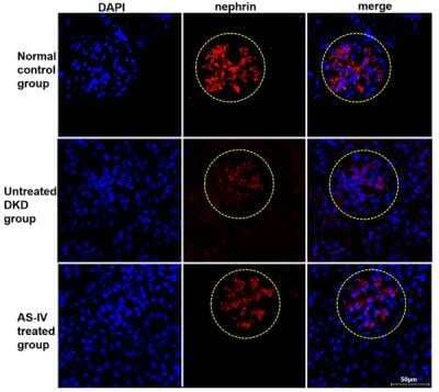 Immunocytochemistry/ Immunofluorescence: Nephrin Antibody - BSA Free [NBP1-77303]