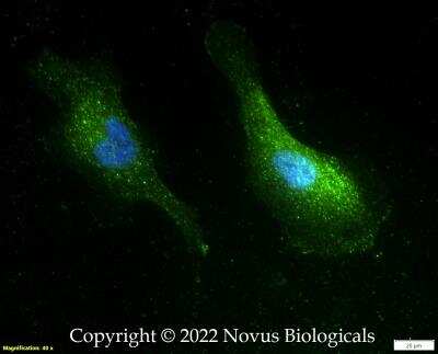 Immunocytochemistry/ Immunofluorescence: Nephrin Antibody [NBP3-18058]