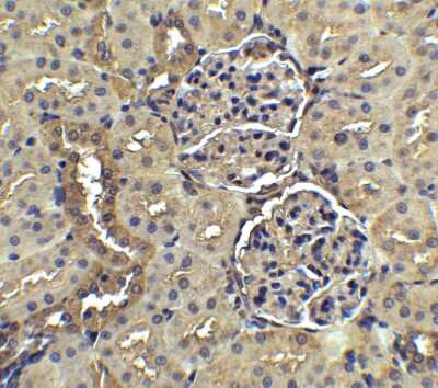 Immunohistochemistry: Nephrin Antibody - BSA Free [NBP1-77303]