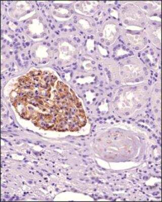 Immunohistochemistry-Paraffin: Nephrin Antibody [NBP3-18058]