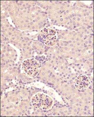 Immunohistochemistry-Paraffin: Nephrin Antibody [NBP3-18058]