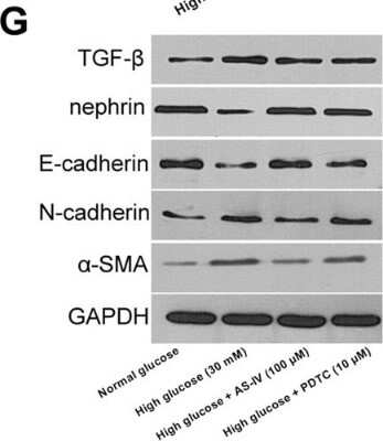 Western Blot: Nephrin AntibodyBSA Free [NBP1-77303]