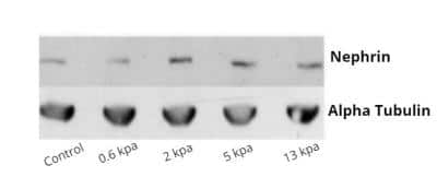 Western Blot: Nephrin Antibody (Y17-R) [NBP1-30130]