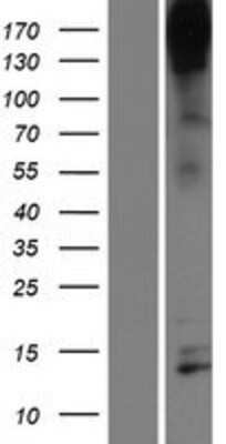 Western Blot: Nephrin Overexpression Lysate [NBP2-10533]