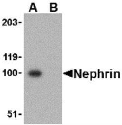 Western Blot: Nephrin Antibody Blocking Peptide [NBP1-77303PEP]