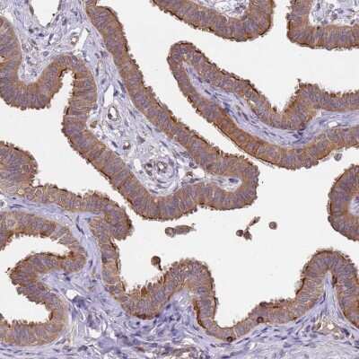 Immunohistochemistry-Paraffin: Nephronophthisis Antibody [NBP2-13672]